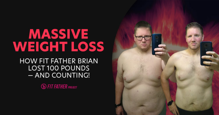 massive weight loss