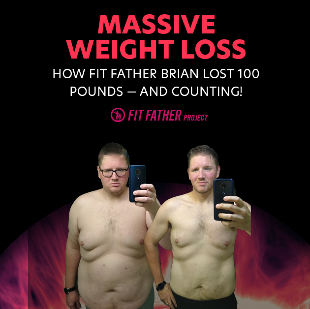 massive weight loss